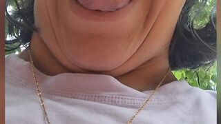 uvula of a trio