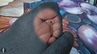 ITCH REVENGE