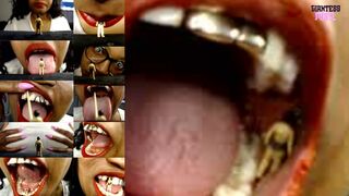 Tiny Dentist Fixed Giant Teeth - A Battle of Trust, Vore, Shrinking Fetish And Mouth Fetish
