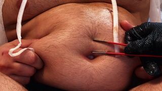 Clinical Insertion: Deep Bellybutton Exam