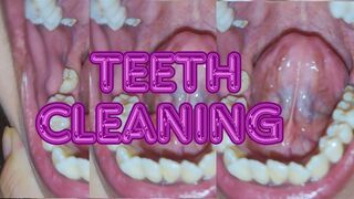 Teeth cleaning