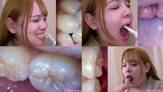 Nina Nishimura - Observing Nina's teeth, mouth, and throat with a dental camera - MOV