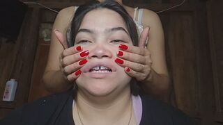 Facial exercises for her distorted face in slow motion