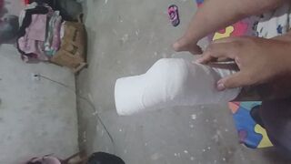 PE WITH PLASTER SPLINT