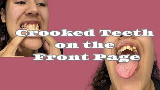 Imperfect teeth