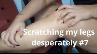 Scratching my legs desperately. #7