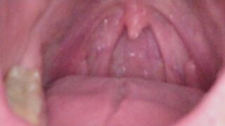 I paralyze you with my beautiful eyes and eat you vore style