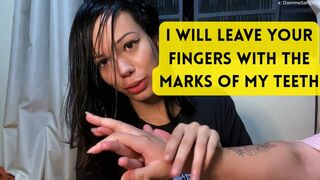 Biting my friend's hands and fingers repeatedly after losing at rock-paper-scissors