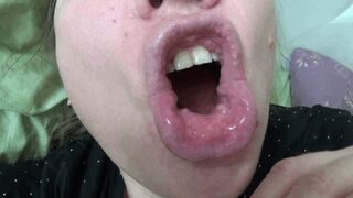 My morning bad breath and dirty tongue 2 y