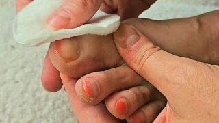 Cleaning off the mess