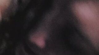 Star W(oral)