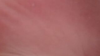 The soles of my defective feet