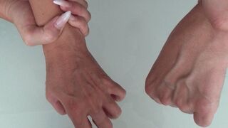 LARGE VEINS ON THE ARMS (hex)