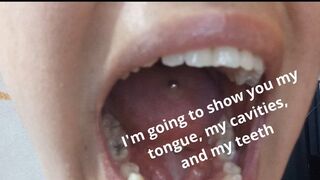 I'm going to show you my tongue, my cavities, and my teeth