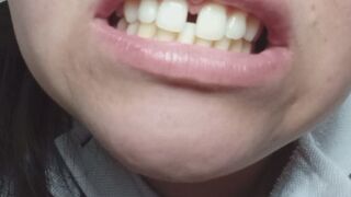Admire my imperfect teeth - fetish