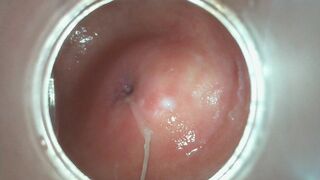 Cervix Contracting during orgasm