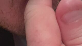 Short bitten nails
