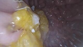 Endoscopic Exploration of a Mandarin Orange (part 2)