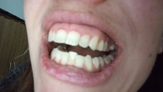 My teeth and molars